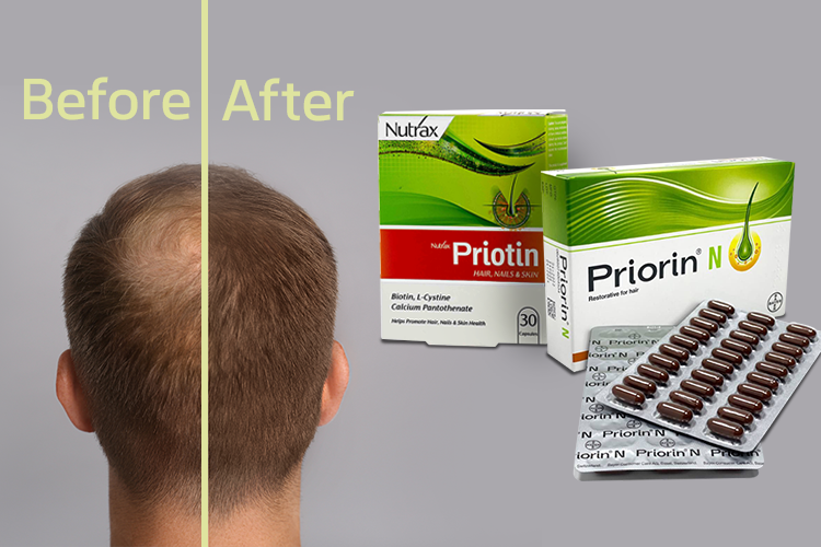 پریورین باعث رشد موها می شود.